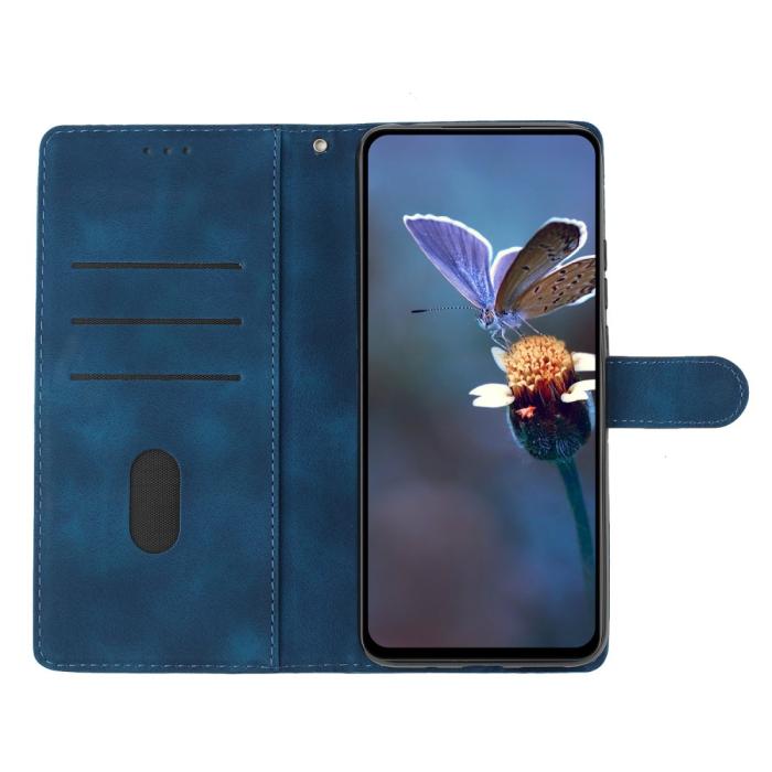 Bild 3, Samsung Galaxy A36 5G/A56 5G Fodral Med Blommigt Tryck